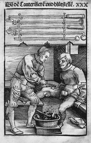 Los 240 - Hortus Sanitatis - 6 Werke in 5 Bänden, teils als größere, umfangreiche Fragmente - 3 - thumb