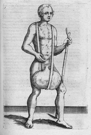 Lot 337, Auction  118, Severino, Marco Aurelio, De recondita abscessuum natura