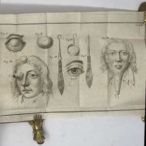 Lot 339, Auction  122, Medizin, 5 Werke über Krankheiten und deren Behandlung